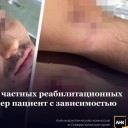 Бастрыкин затребовал доклад об истязании пациента в рехабе Пятигорска