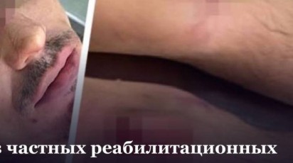В рехабе Пятигорска пациента залечили до смерти обертываняими в ковер с прыжками по нему