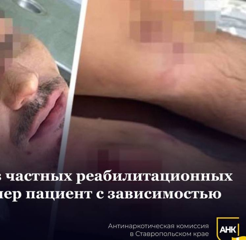 В рехабе Пятигорска пациента залечили до смерти обертываниями в ковер с прыжками по нему