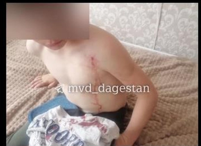 <i>В Дагестане 9-летний мальчик выстрелил в сверстника из «пневматики»</i>