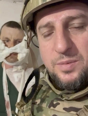 Кадыров показал единственного выжившего в противостоянии спецназовцам из Чечни