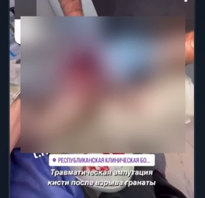 Представителя МВД Дагестана возмутили съемки ампутации руки в больнице